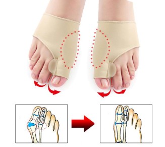Orthopedic Bunion Corrector Sleeve