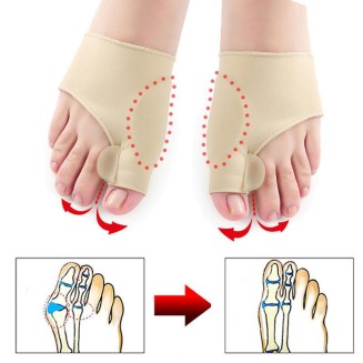 Orthopedic Bunion Corrector Sleeve